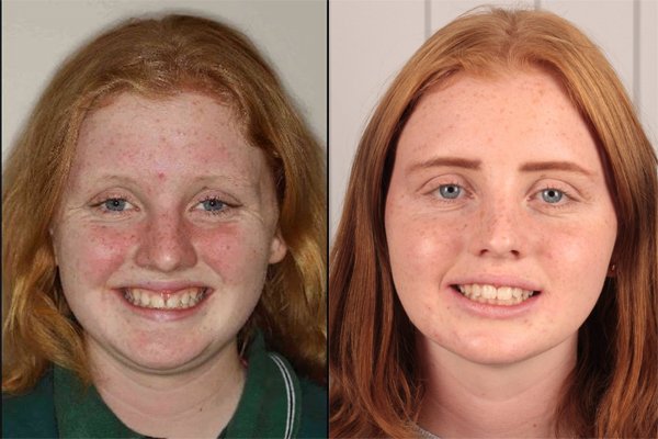 glenview dental treatment